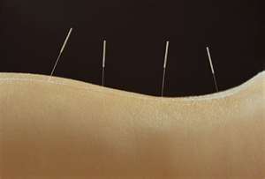 back needles